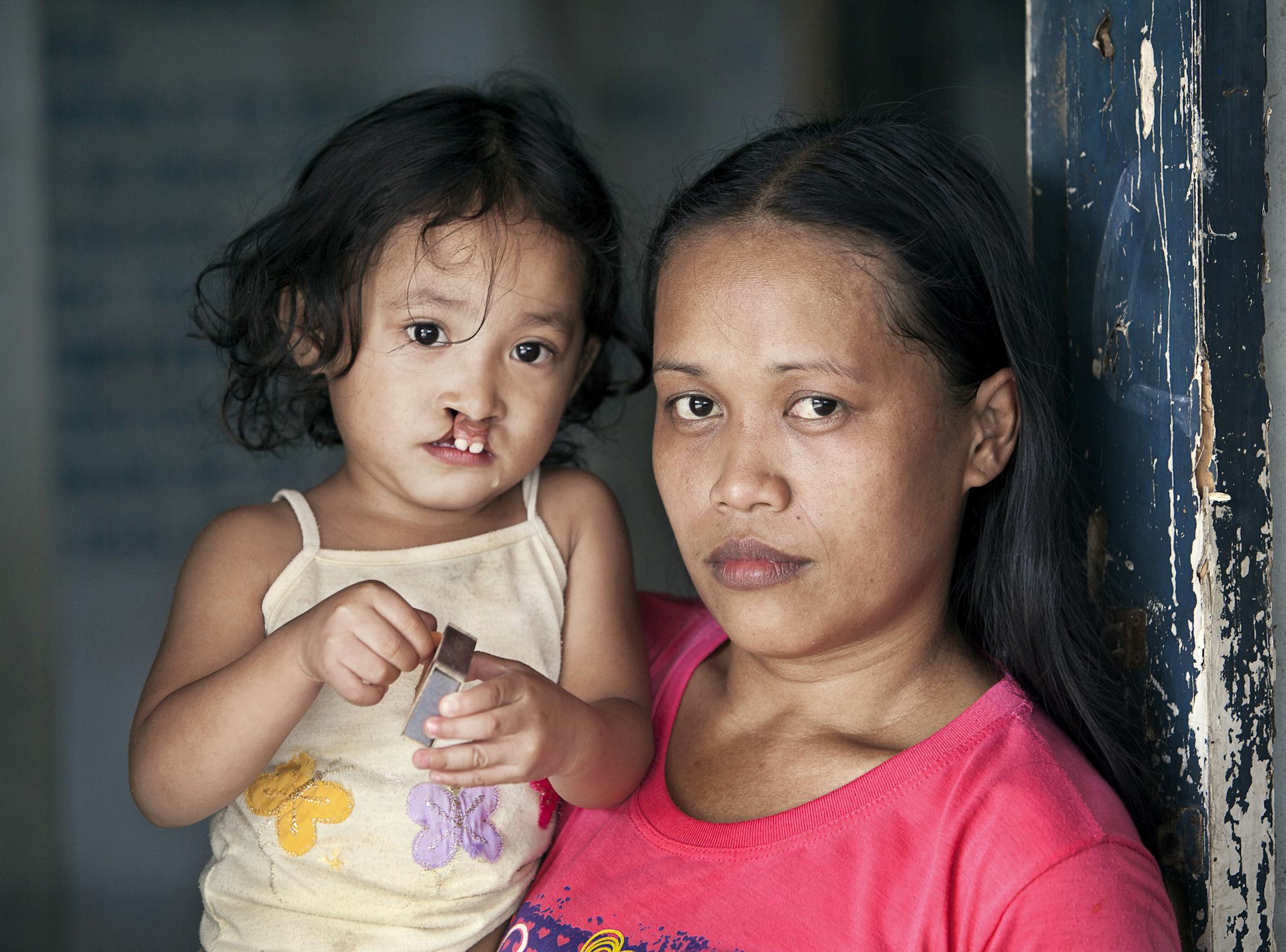 liten flicka med sin mamma innan operation