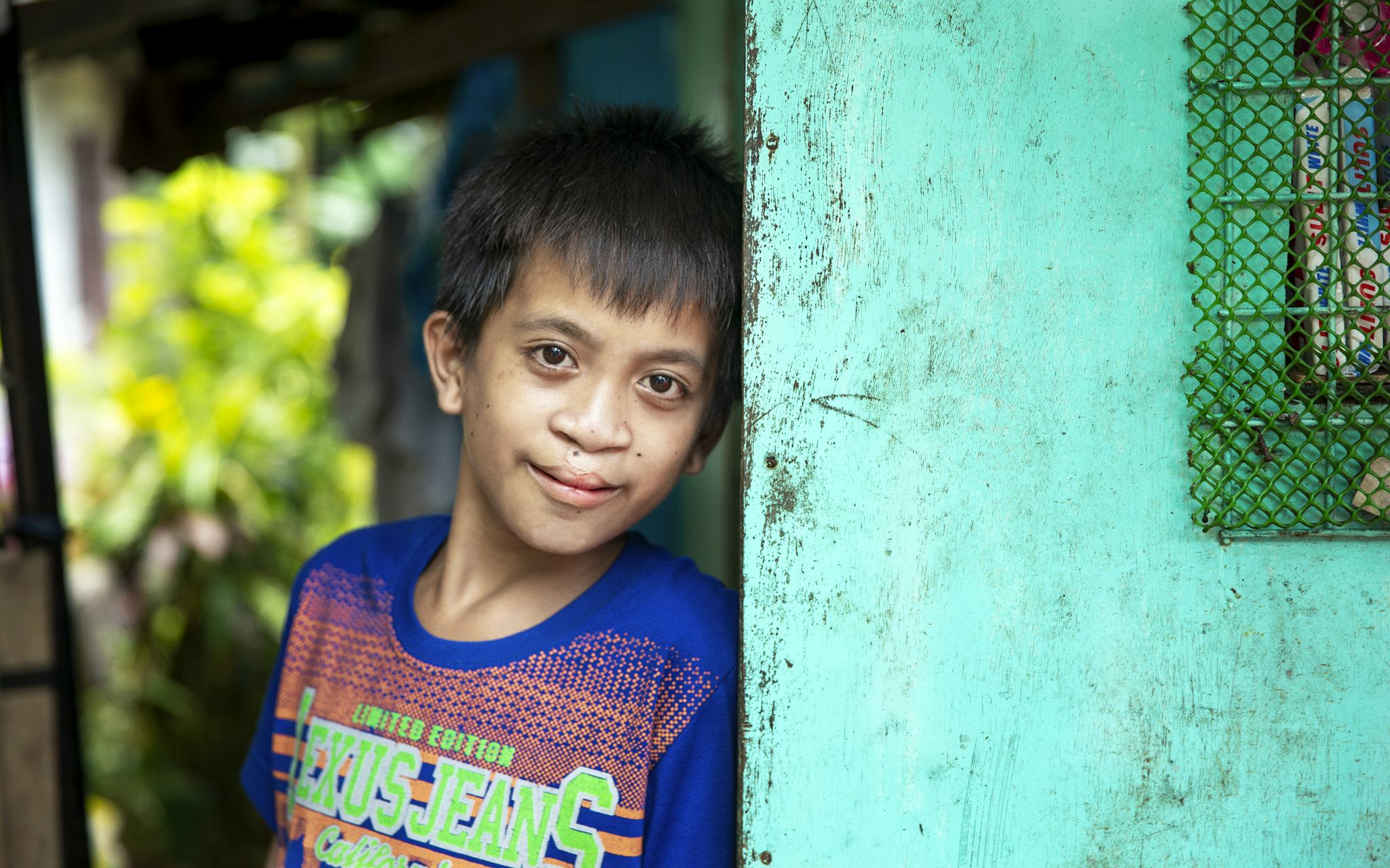 En 12-årig pojke lutar sig mot en färgglad vägg och tittar rakt in i kameran med ett försiktigt leende. Han har fina ärr mellan läpp och näsa sedan en spaltoperation.