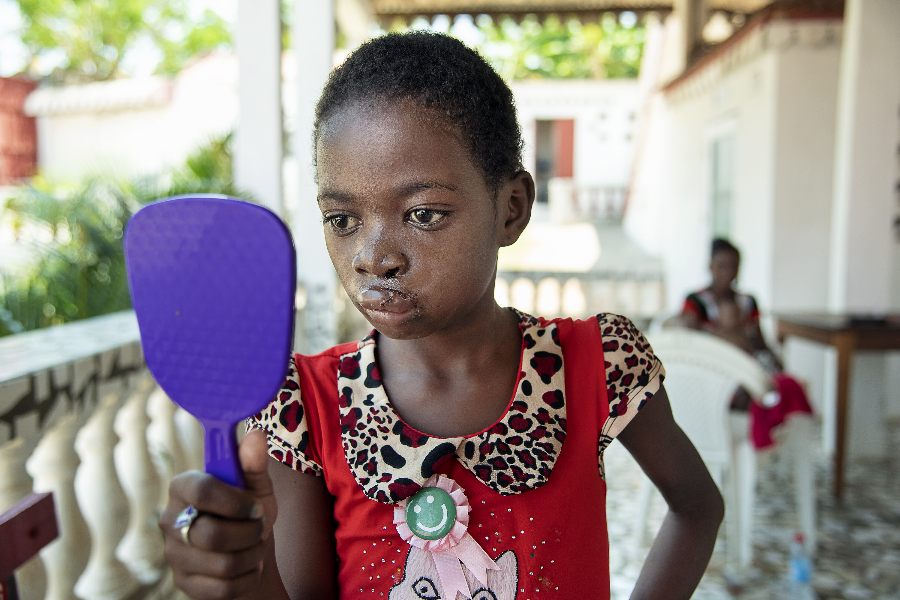 En flicka med läppspalt i röd klänning tittar på sig själv i en lila handhållen spegel på en veranda.
