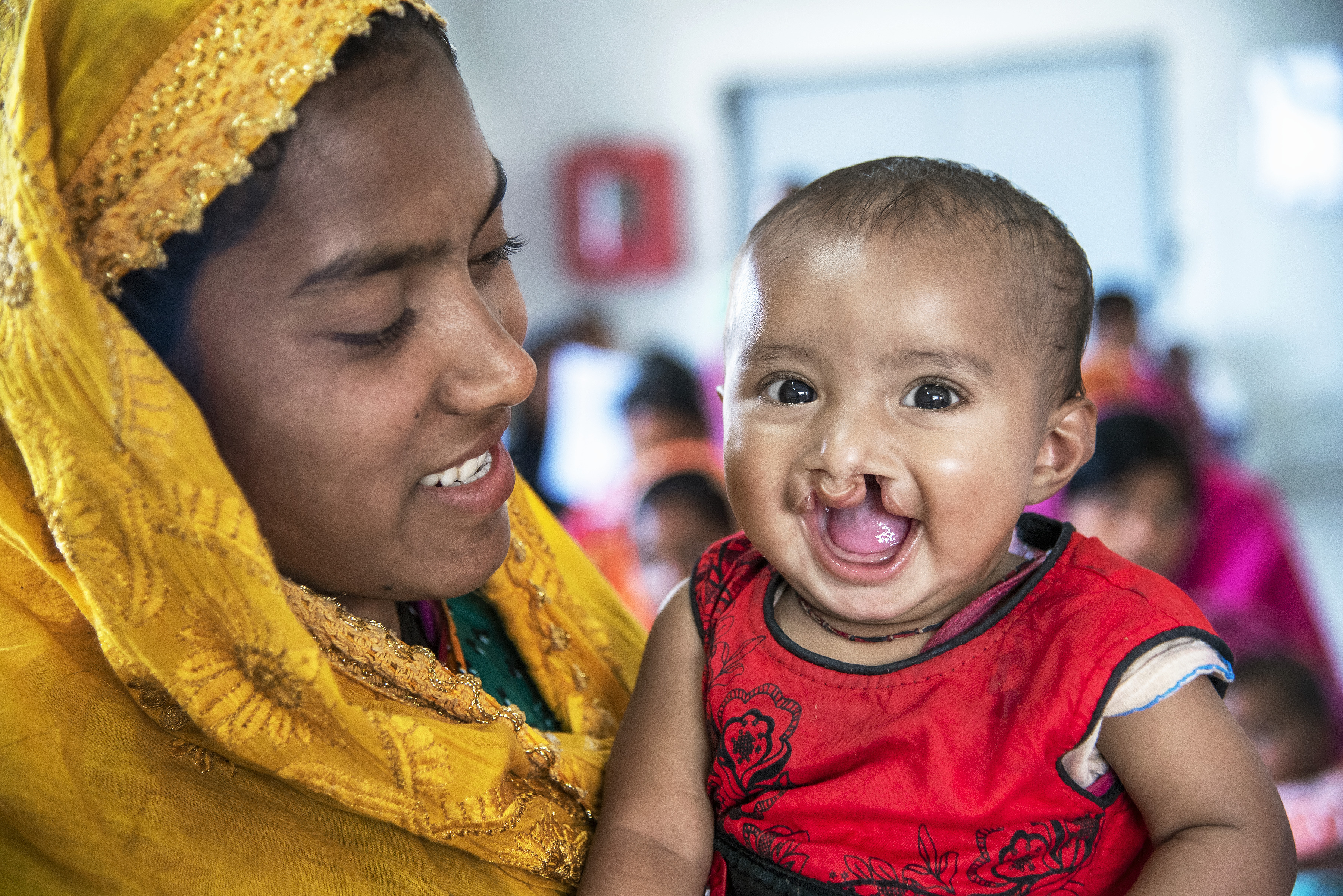 En kvinna med gul sjal håller i en bebis med läppspalt. Båda tittar mot kameran.