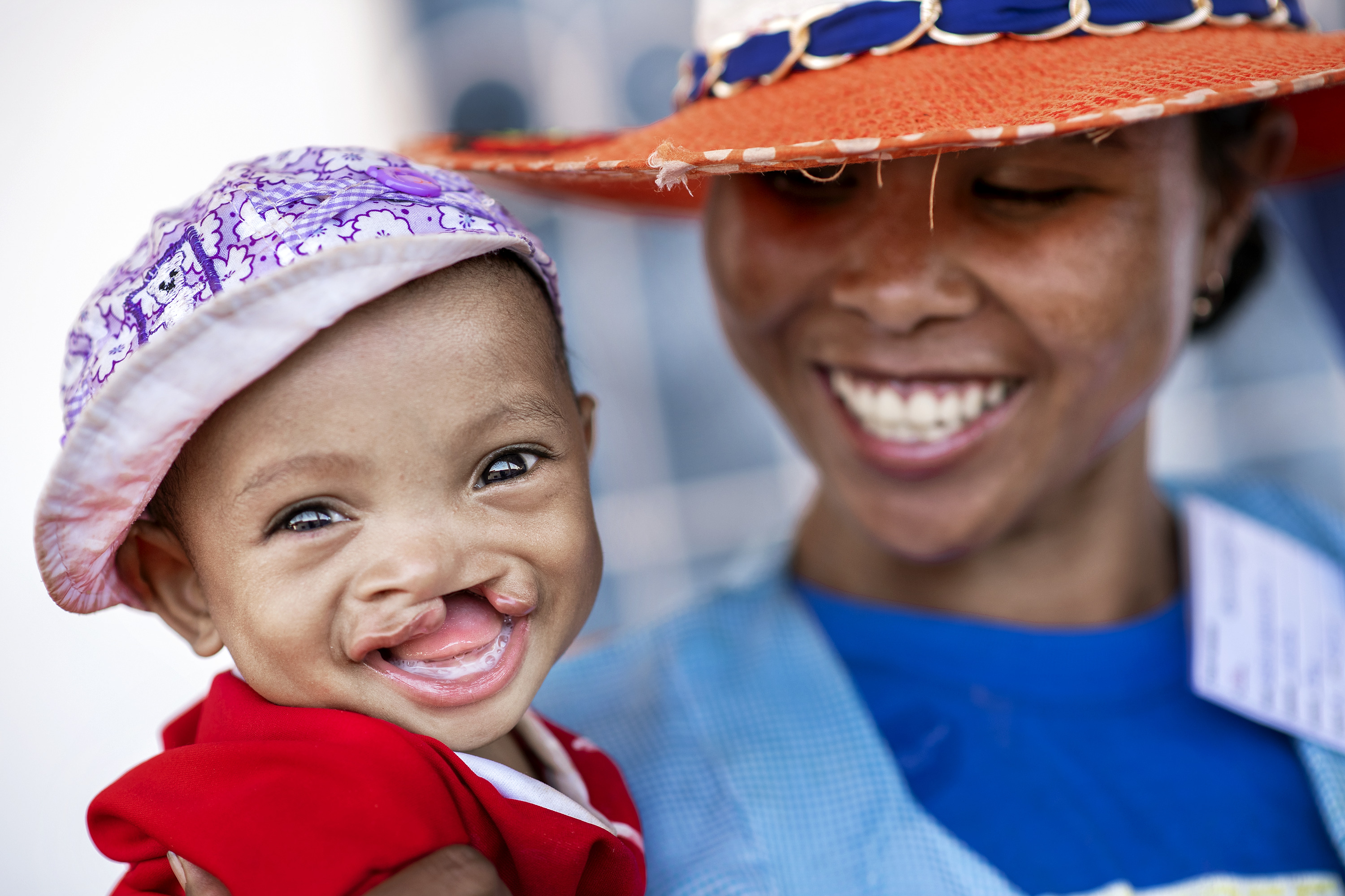En kvinna håller en bebis med läppspalt, båda har kläder och hattar på sig.