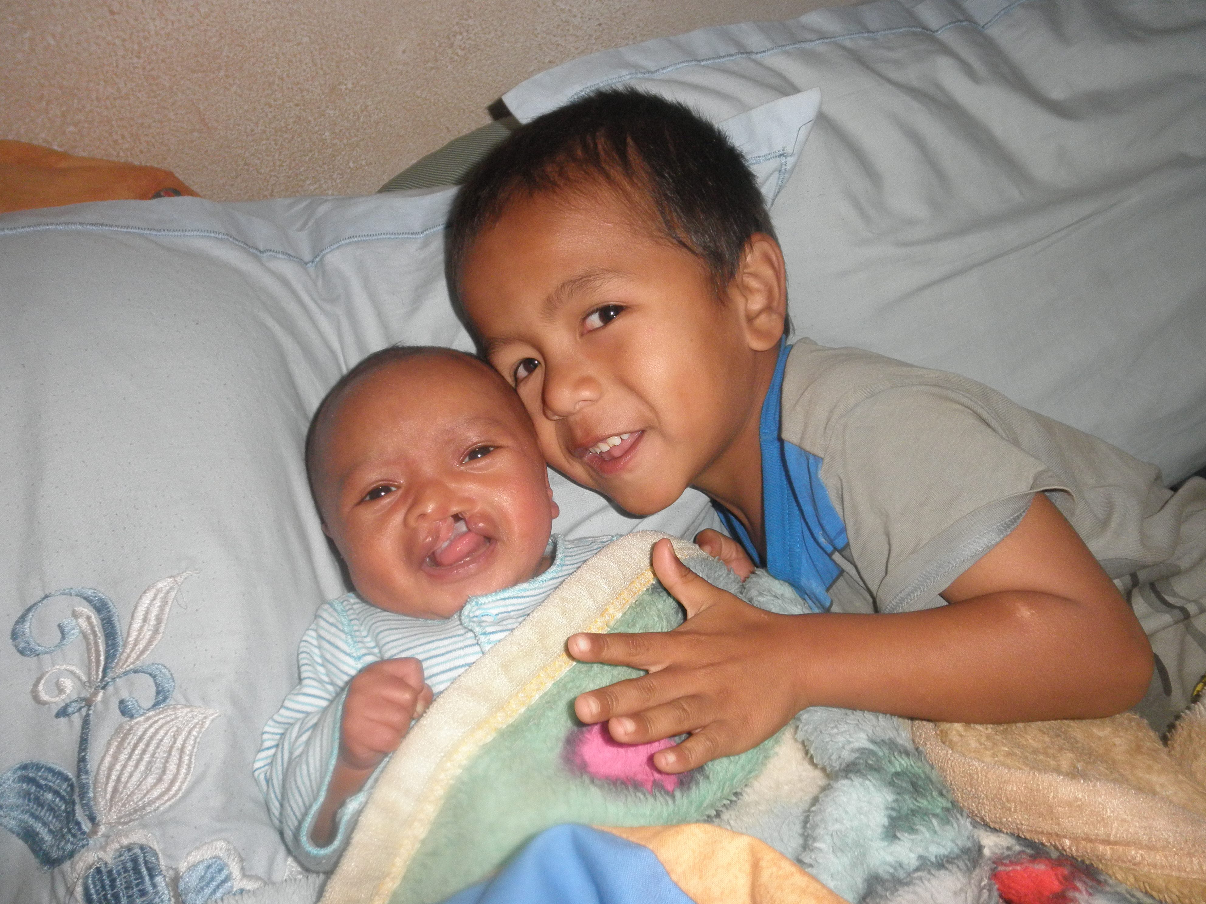 En bebis med läpp-käk-gomspalt ligger i en säng. Bredvid ligger en lite äldre pojke, ca 3 år gammal. Pojken håller sin hand på bebisens mage och ler mot kameran.