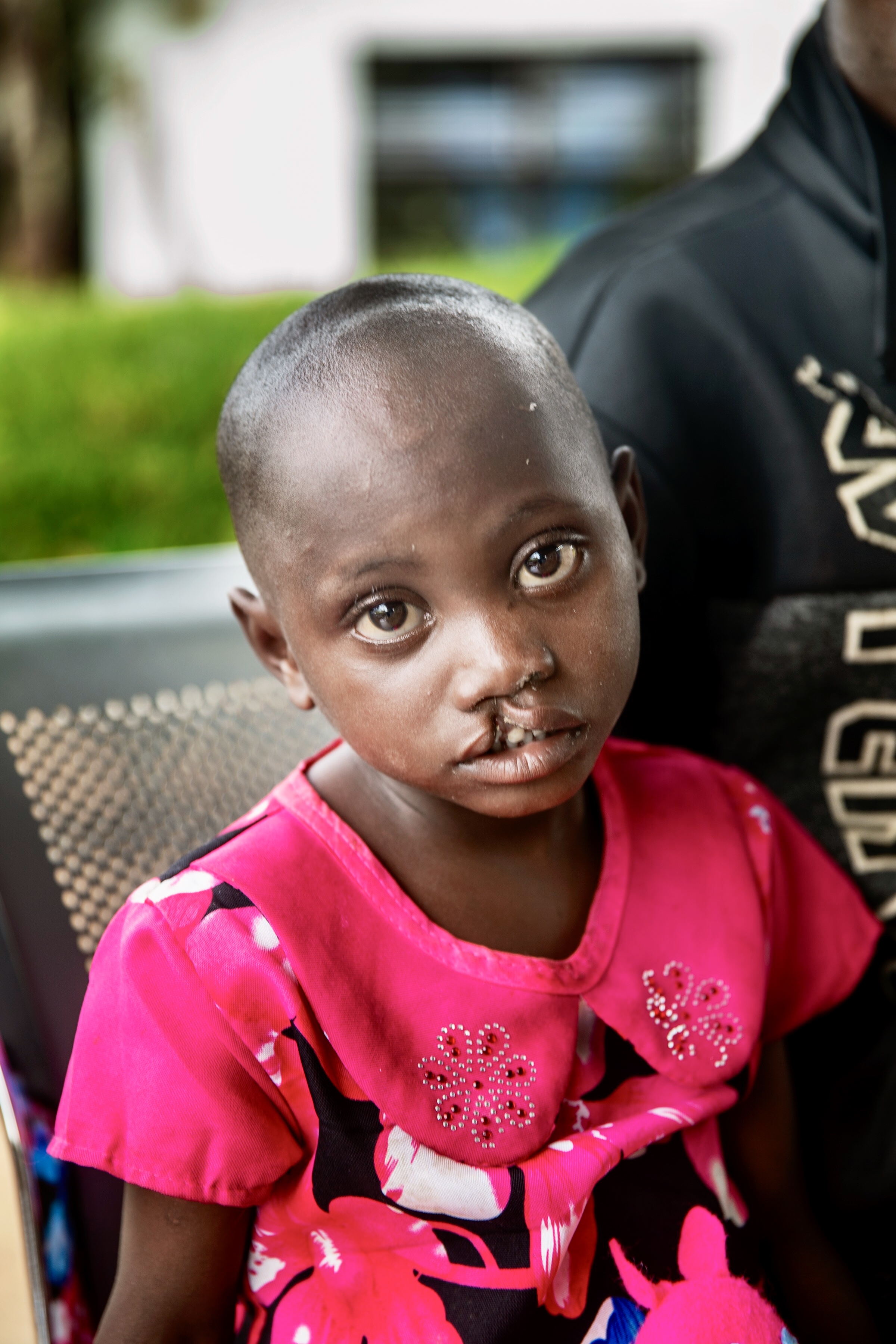 Valentine iklädd rosa klänning tittar allvarligt in i kameran före sin operation