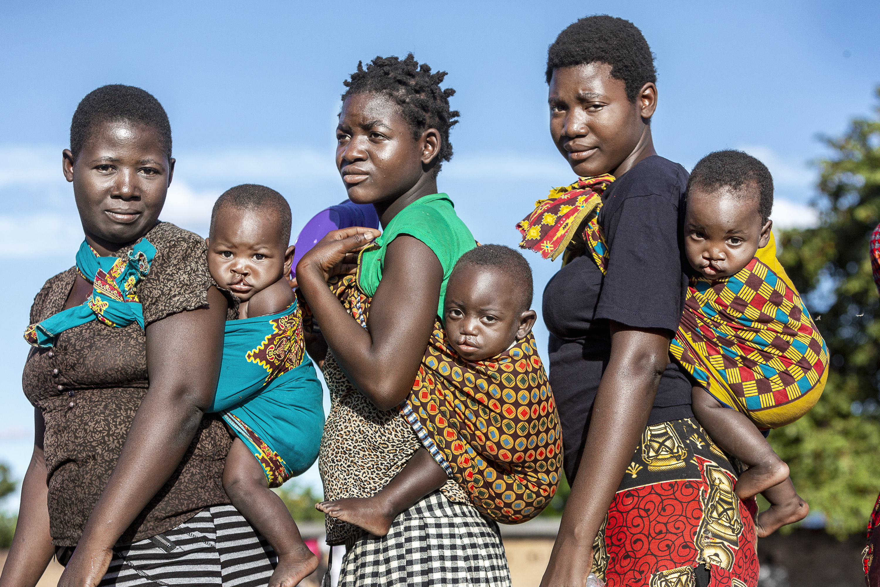 Tre mammor från Malawi står på rad med sina barn på ryggen i färgglada bärsjalar. Barnen har alla läpp-käk-gomspalt.