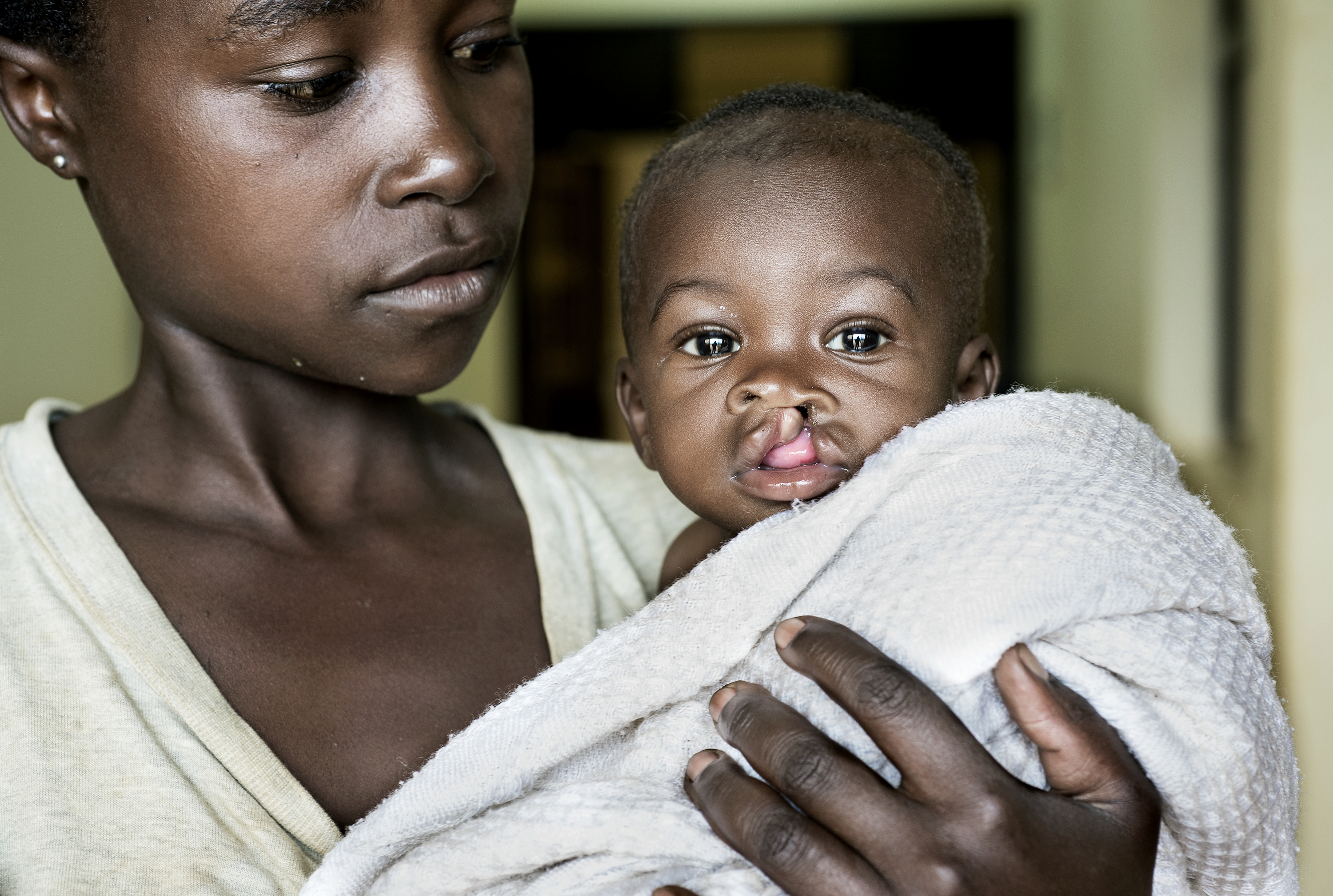 En mamma håller sitt barn i famnen. Barnet har spalt och är invirad i en beige filt.