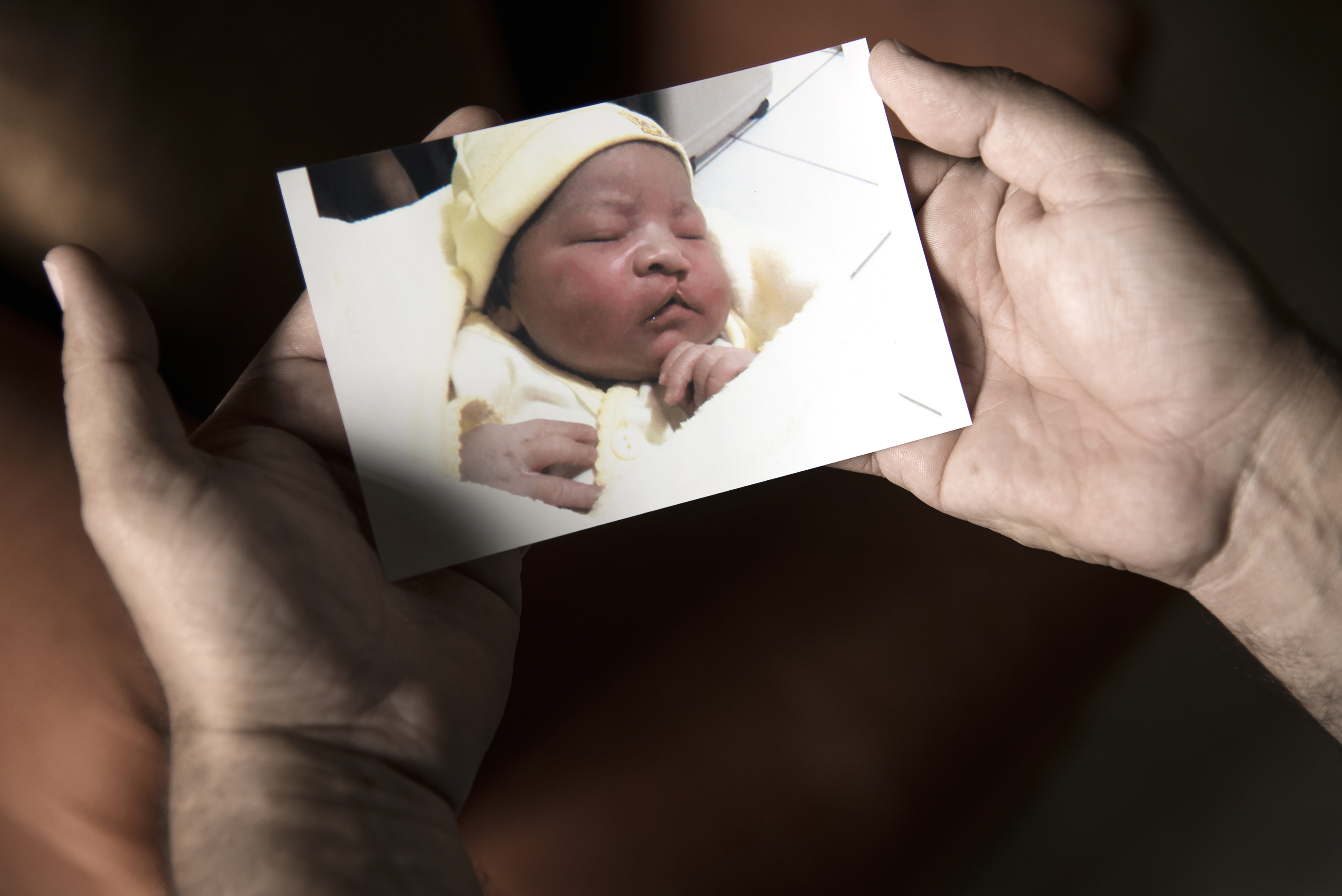 Ett par händer håller ett fotografi på ett sovande barn. Barnet är klädd i ljusgul mössa och är har en nyopererad läpp-käk-gomspalt