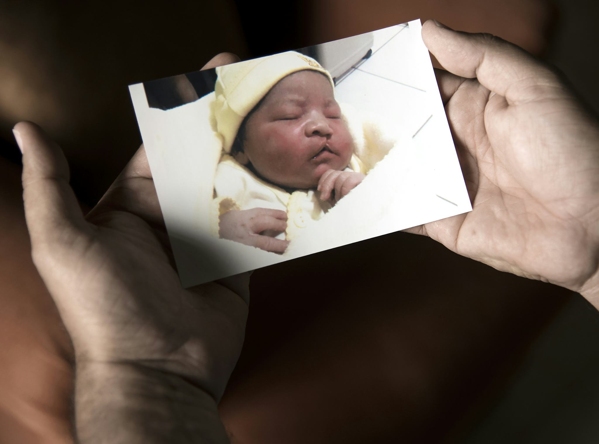 Ett par händer håller ett fotografi på ett sovande barn. Barnet är klädd i ljusgul mössa och är har en nyopererad läpp-käk-gomspalt