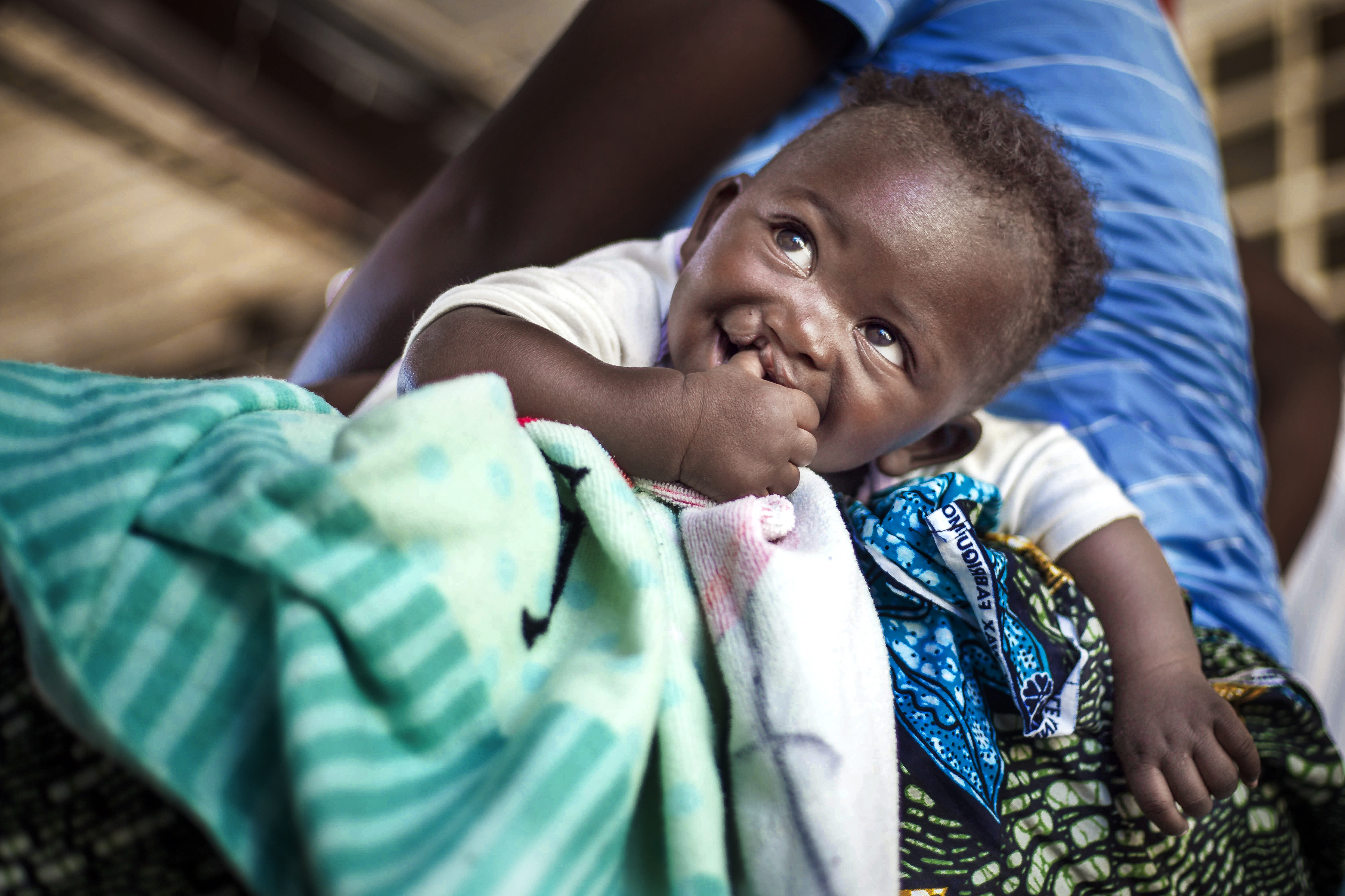 Liten pojke med läpp-käk-gomspalt. Pojken har tummen i munnen. Han ligger i en kvinnas famn och ler mot henne.
