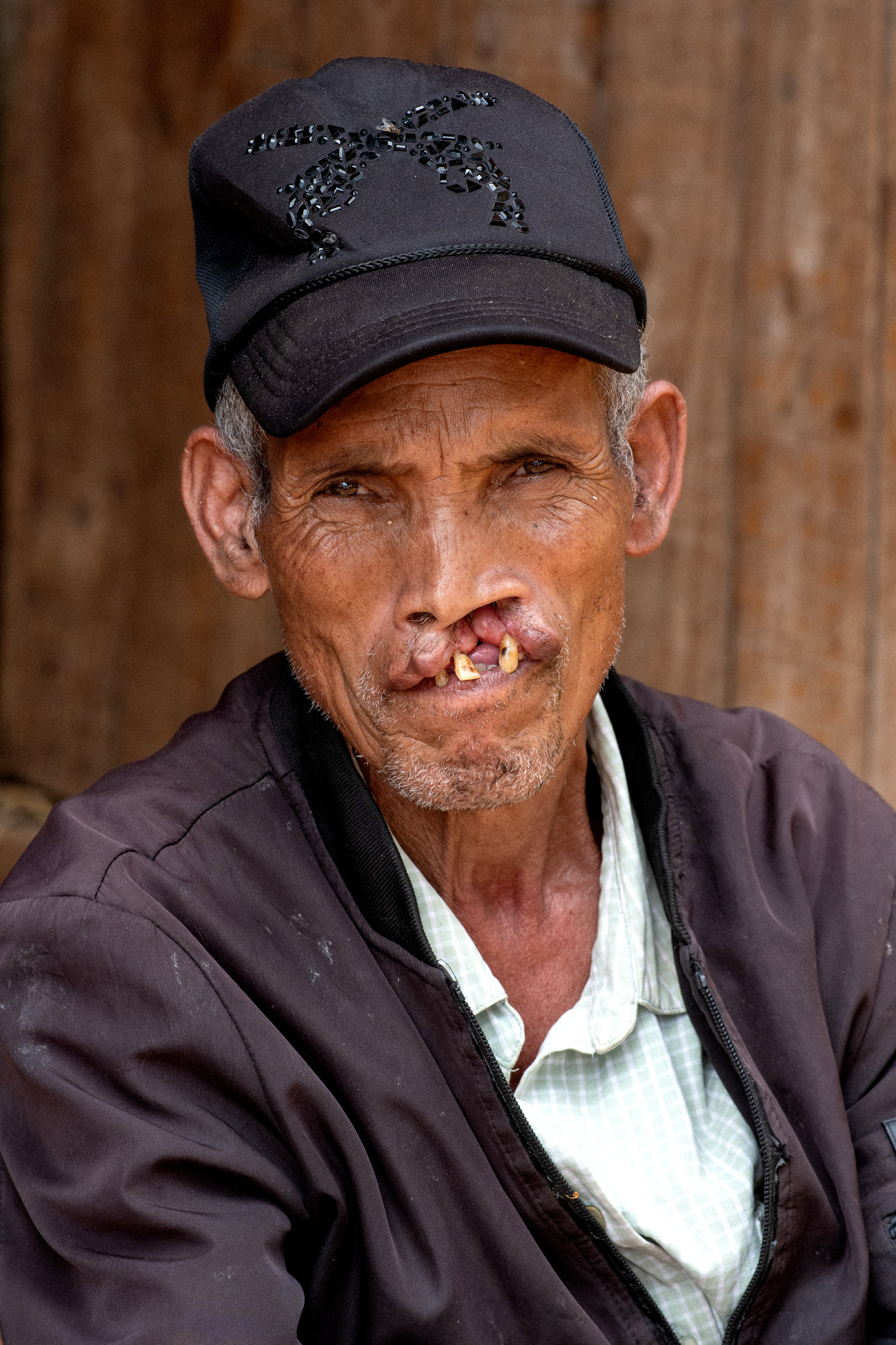 En äldre man med svart keps och mörk jacka sitter framför en bakgrund av trä. Han har läppspalt och tittar mot kameran.