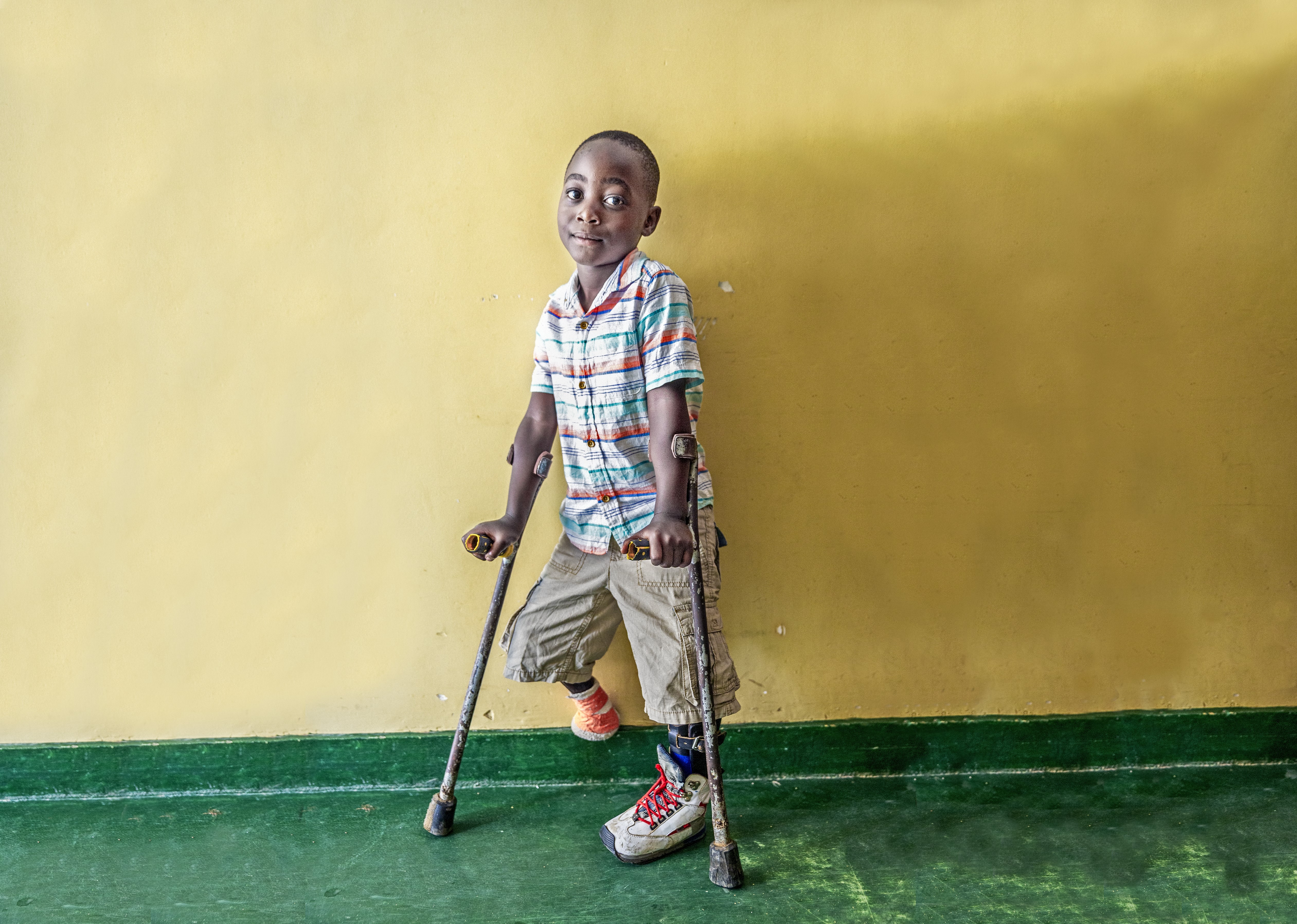 En pojke står på kryckor mot en gul vägg. Pojken saknar en fot.