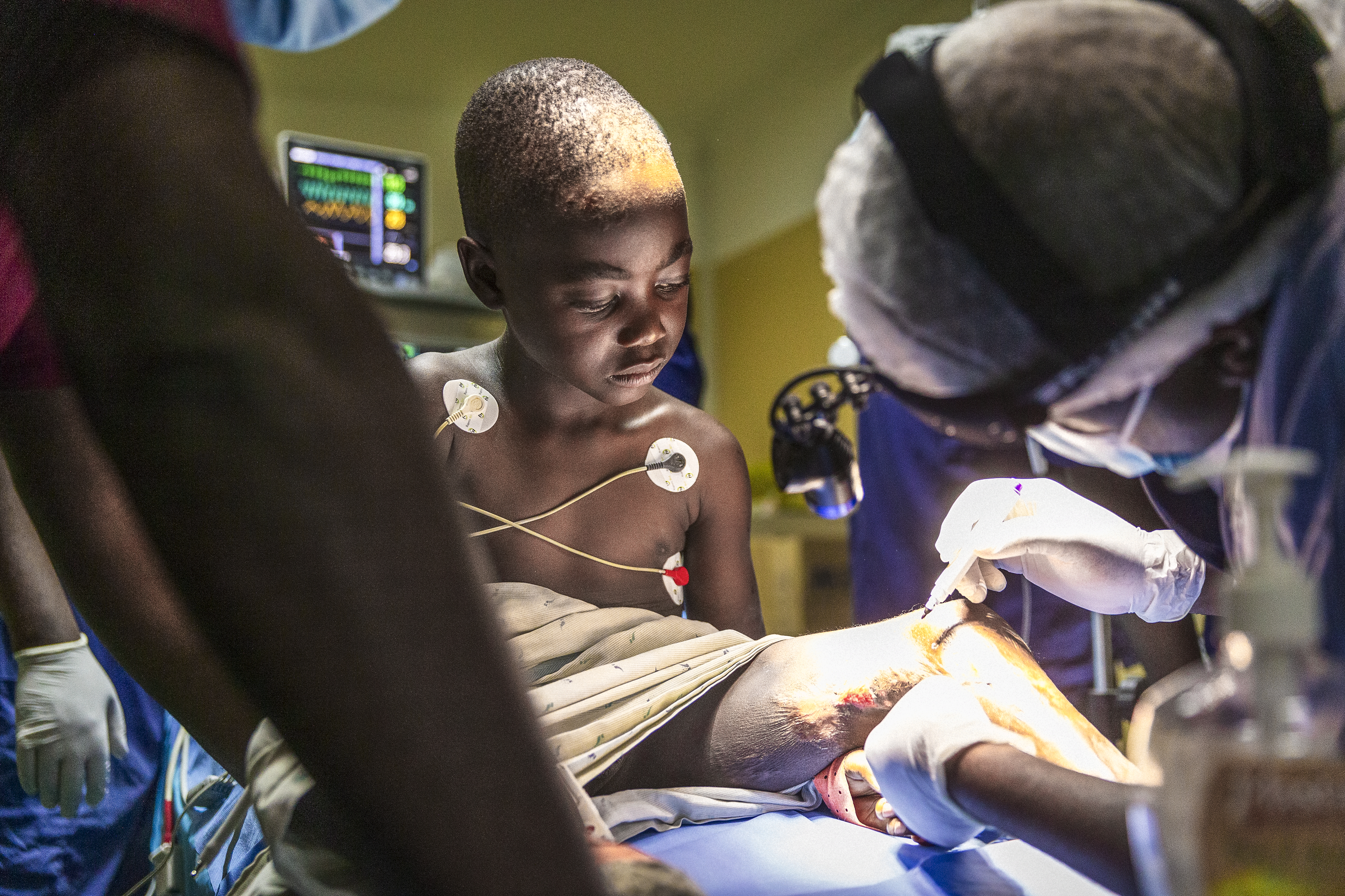 En flicka på ett operationsbord får sitt skadade ben undersökt av en kirurg.
