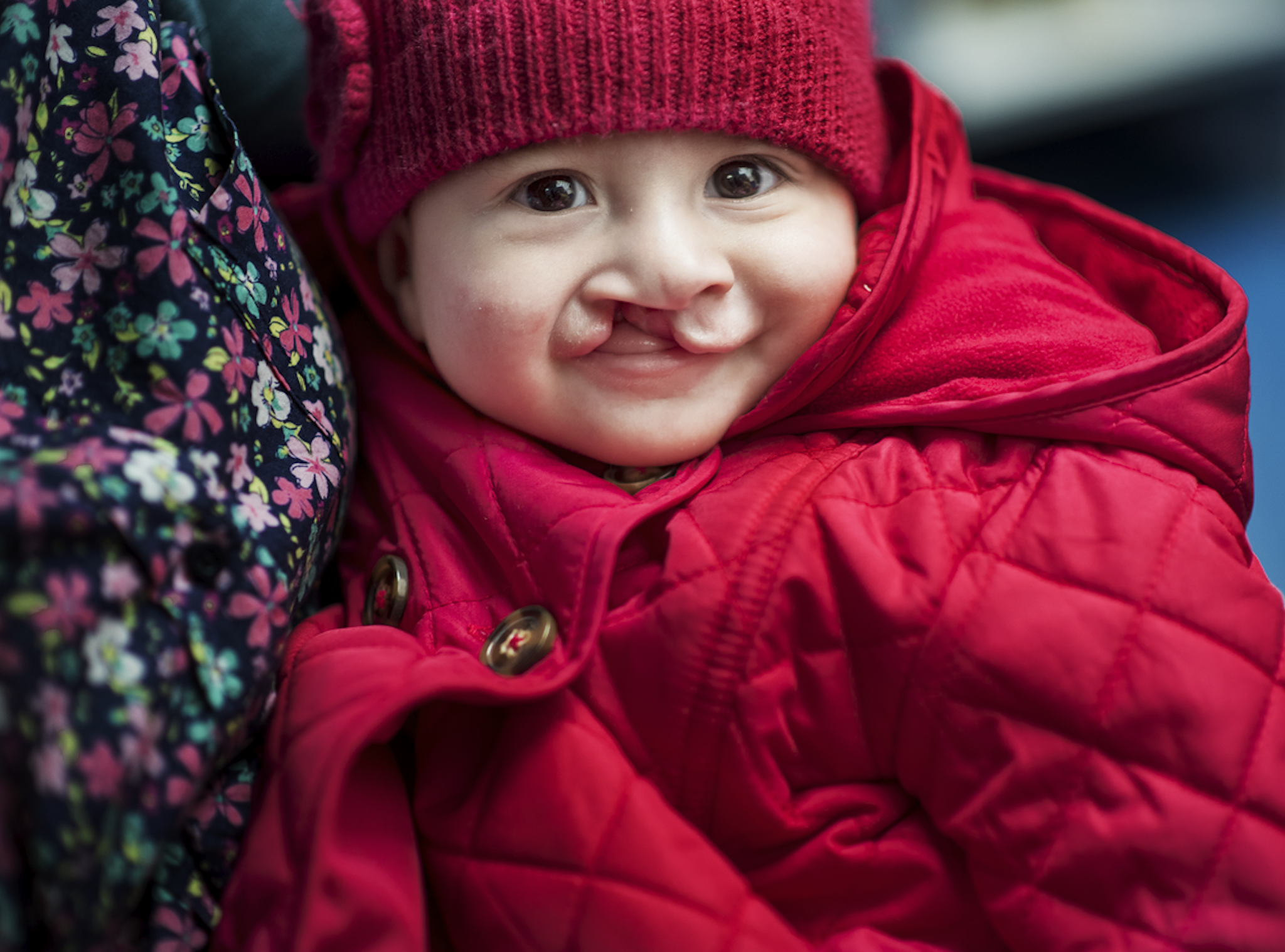 En baby med röd stickad mössa och röd quiltad jacka tittar in i kameran och har läppspalt.