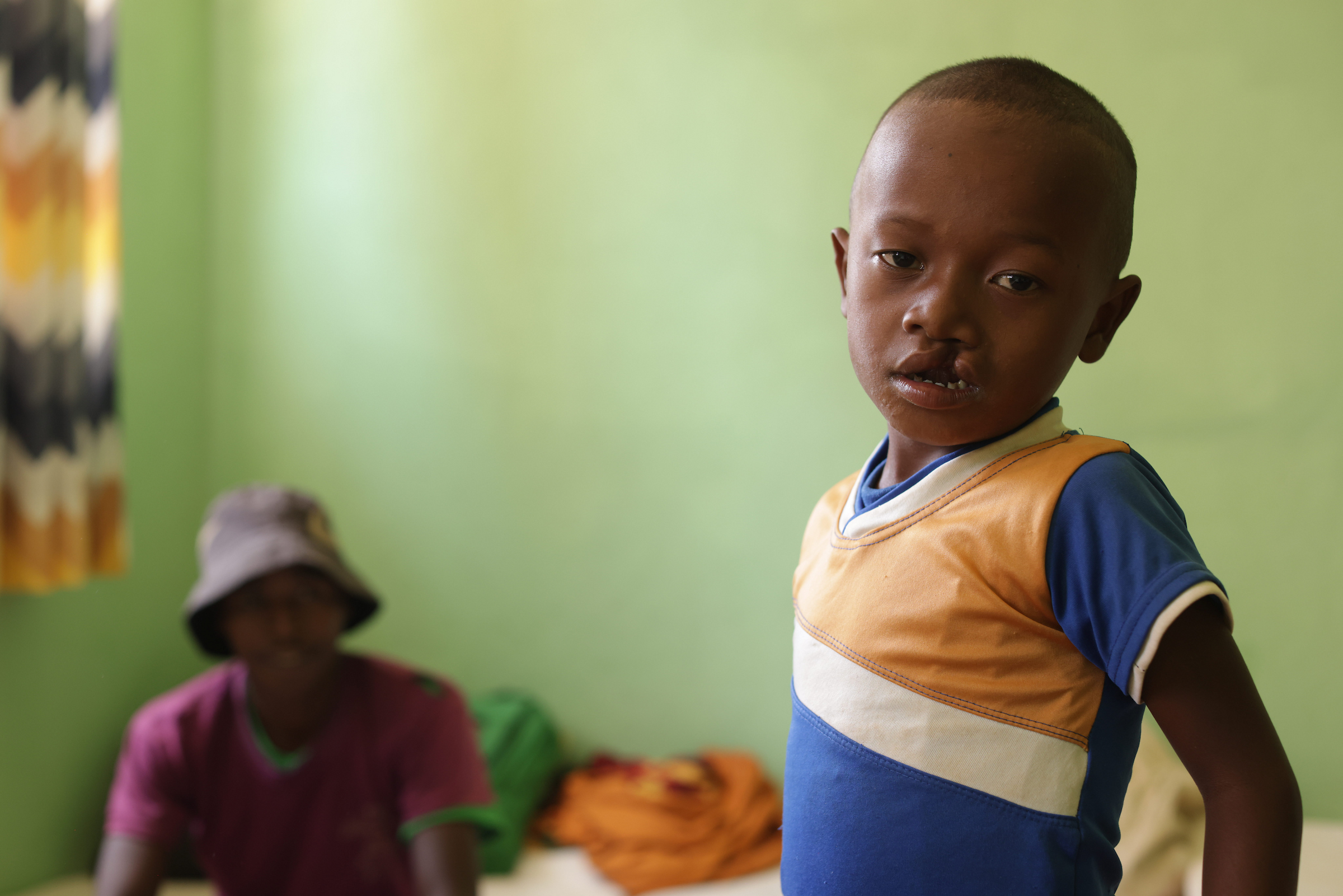 En liten pojke med synlig läppspalt ser lite trött ut in i kamerian. Hans pappa sitter på en säng i bakgrunden.