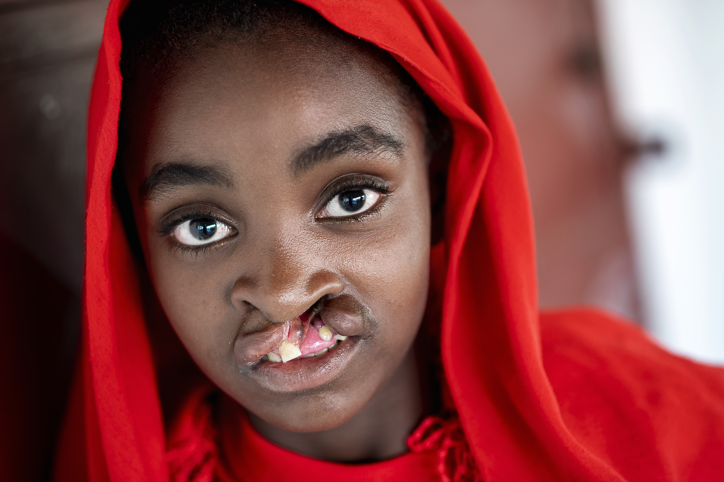 En ung flicka med ett rött huvudscarf och läppspalt tittar rakt mot kameran.