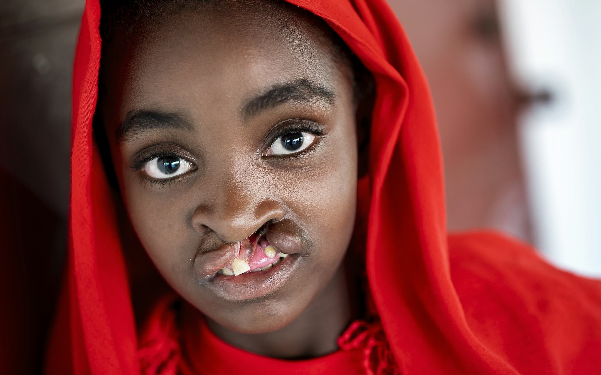 En ung flicka med ett rött huvudscarf och läppspalt tittar rakt mot kameran.