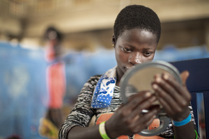 En ung kvinna sitter på en stol inomhus och tittar sig i en spegel. Hon har nyss fått sin läppspalt opererad.