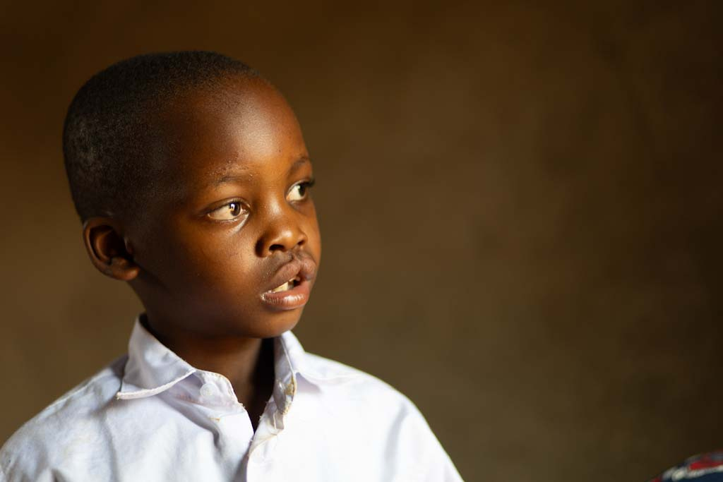 En pojke med läppspalt iklädd vit skjorta tittar åt sidan framför en enfärgad brun bakgrund.